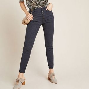 Pilcro High-Rise Jacquard Skinny Jeans
